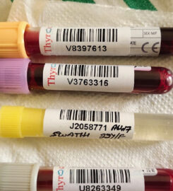 Blood test at home free home collection..Full Body Checkup…Call now