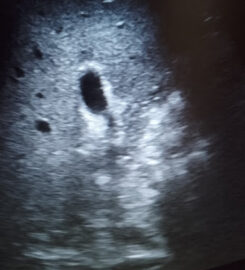 Amrik ultrasound and diagnostic Imaging centre