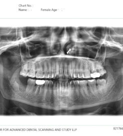UPGRADENT CENTER FOR ADVANCED DENTAL SCANNING AND STUDY LLP