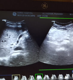 Amrik ultrasound and diagnostic Imaging centre