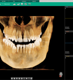 UPGRADENT CENTER FOR ADVANCED DENTAL SCANNING AND STUDY LLP